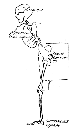 Космическое   тело  Адама с Голгофой-черепом, воспроизводящее топографию Иерусалима (реконструкция).
